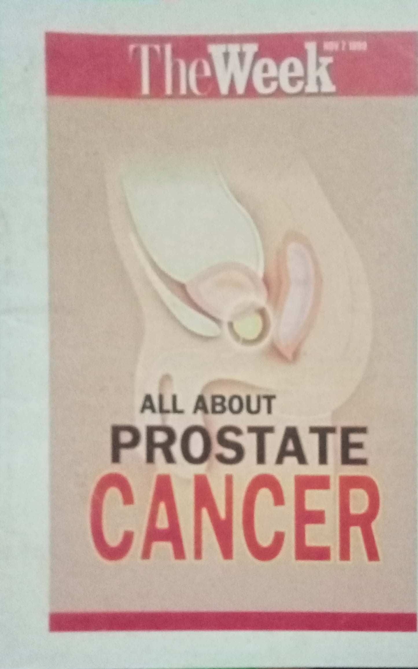 All About Prostate Cancer